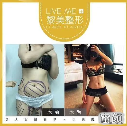案例图片