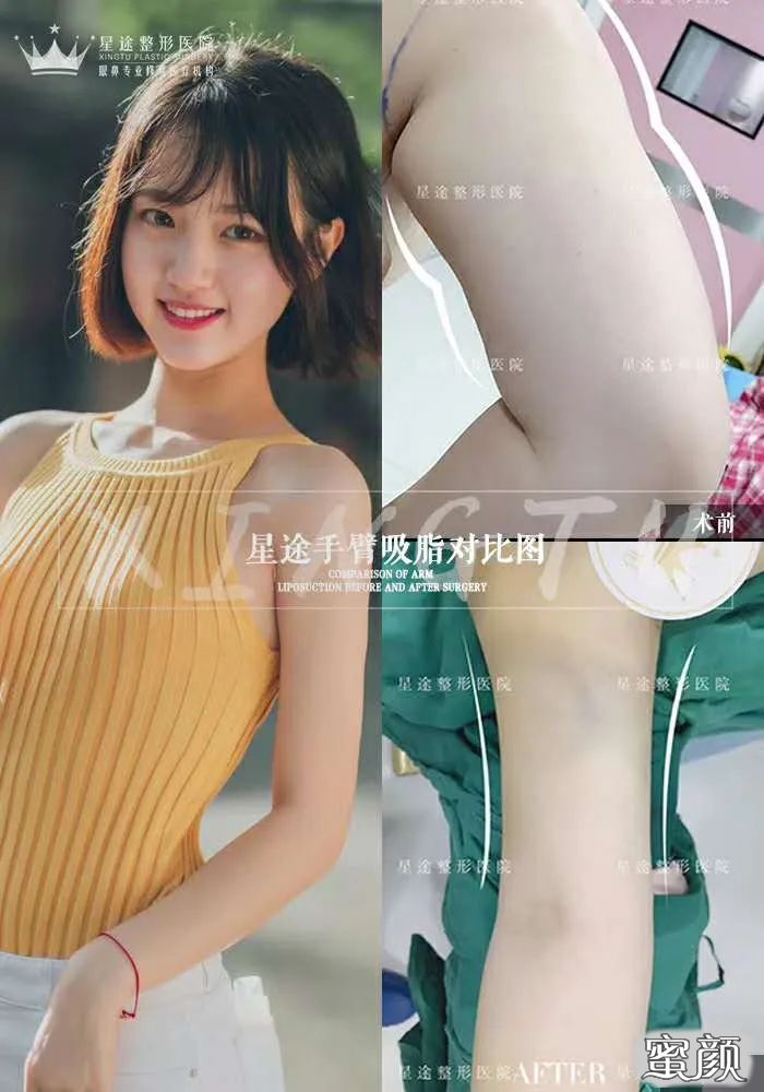 https://img.yiyiaimei.com/mnt/timg/200519/164QK618-1.jpg