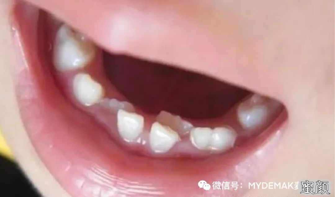 案例图片