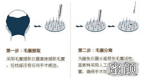 案例图片