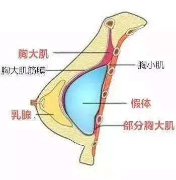 案例图片