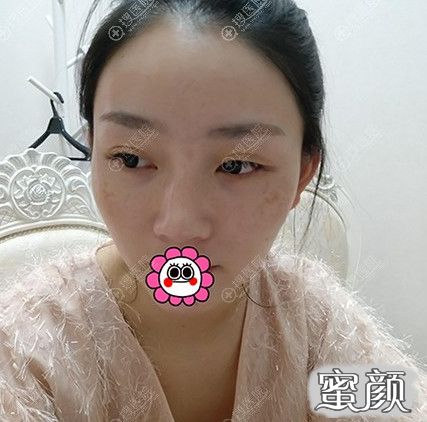 案例图片