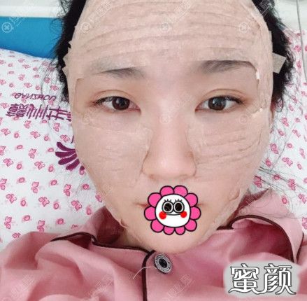 案例图片