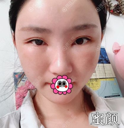 案例图片