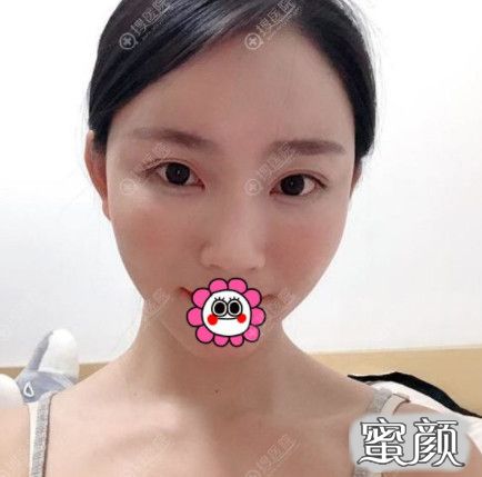 案例图片