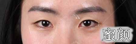 https://img.yiyiaimei.com/mnt/timg/200520/15332C433-0.jpg