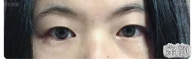 https://img.yiyiaimei.com/mnt/timg/200520/15333T316-2.jpg