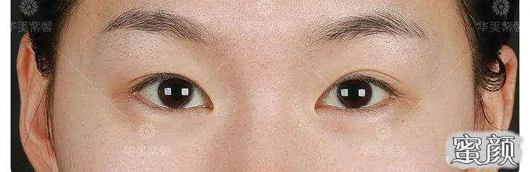 https://img.yiyiaimei.com/mnt/timg/200520/15333aO0-4.jpg