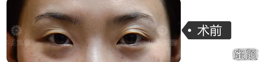 https://img.yiyiaimei.com/mnt/timg/200520/1533402I6-6.jpg