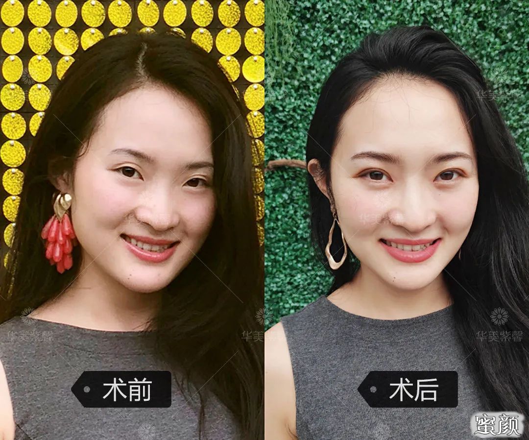 https://img.yiyiaimei.com/mnt/timg/200520/1533421533-7.jpg