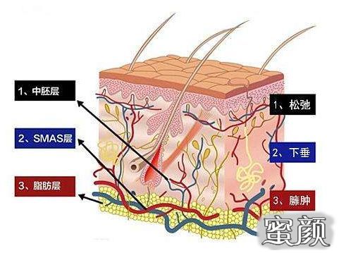 案例图片