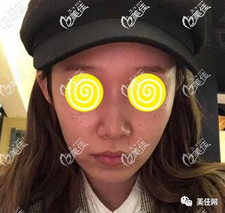 https://img.yiyiaimei.com/mnt/timg/200521/1105405561-2.jpg