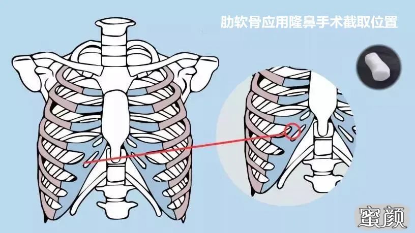 案例图片