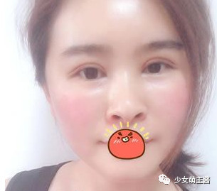 案例图片