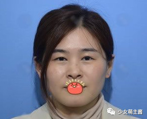 案例图片