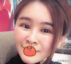 案例图片