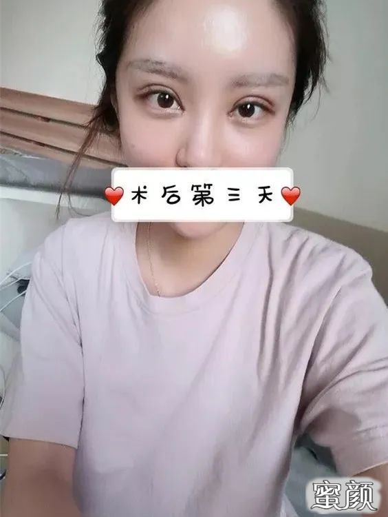 案例图片