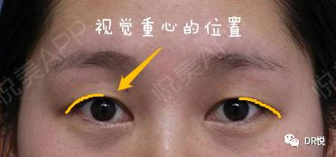案例图片