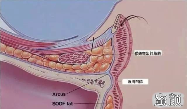 案例图片