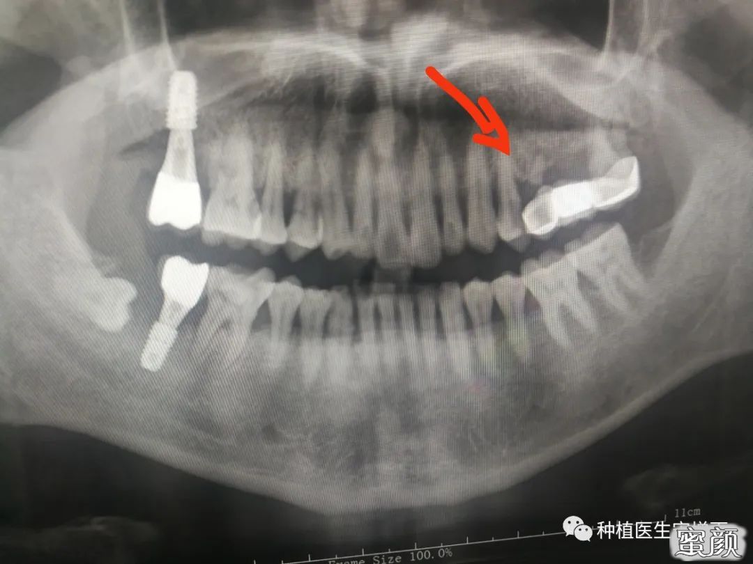 https://img.yiyiaimei.com/mnt/timg/200522/11242640K-4.jpg