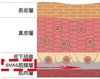 案例图片