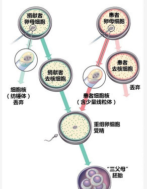 https://img.yiyiaimei.com/mnt/timg/200522/12053524Z-5.jpg 案例图片