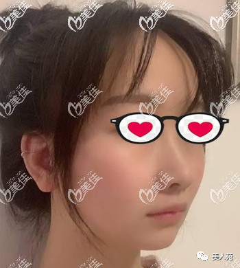 案例图片