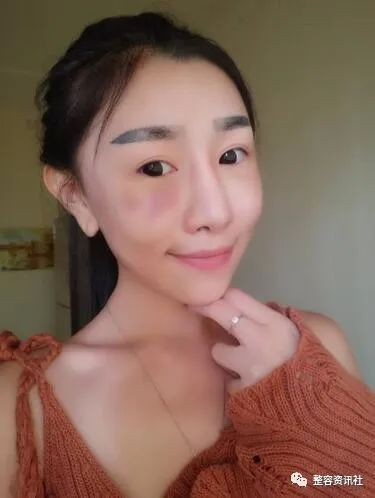 案例图片
