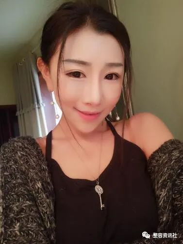 案例图片