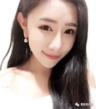 案例图片