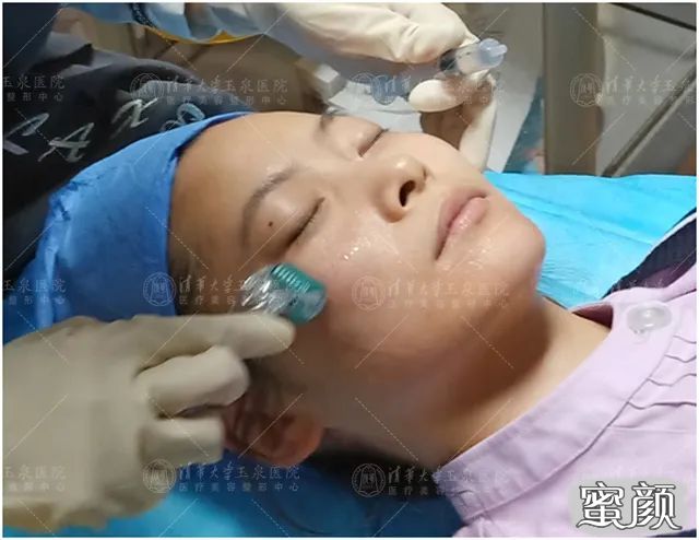 https://img.yiyiaimei.com/mnt/timg/200524/1041315013-0.jpg 案例图片