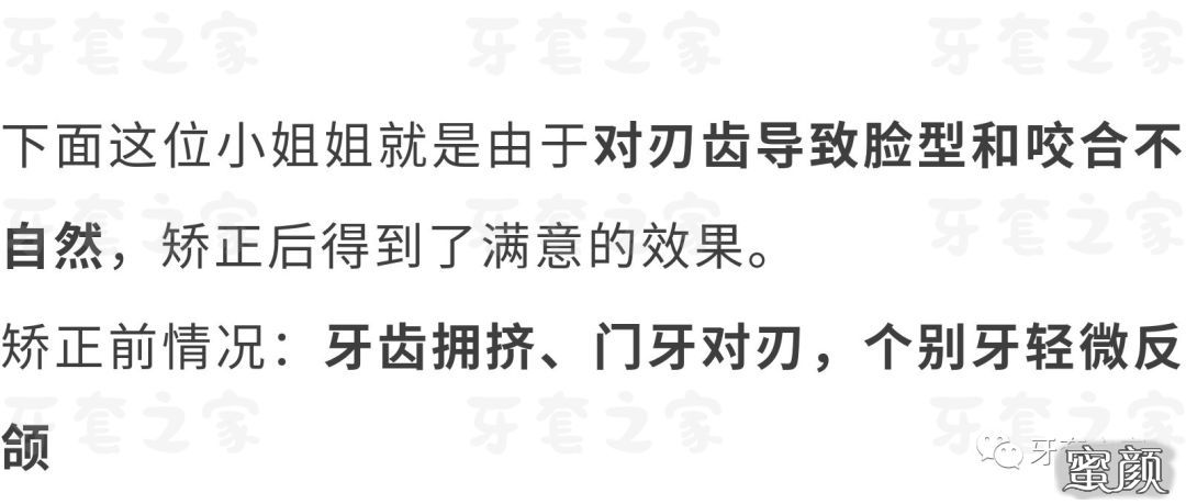 https://img.yiyiaimei.com/mnt/timg/200524/104FM961-5.jpg