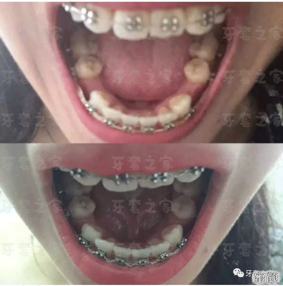 https://img.yiyiaimei.com/mnt/timg/200524/104G14F7-10.jpg