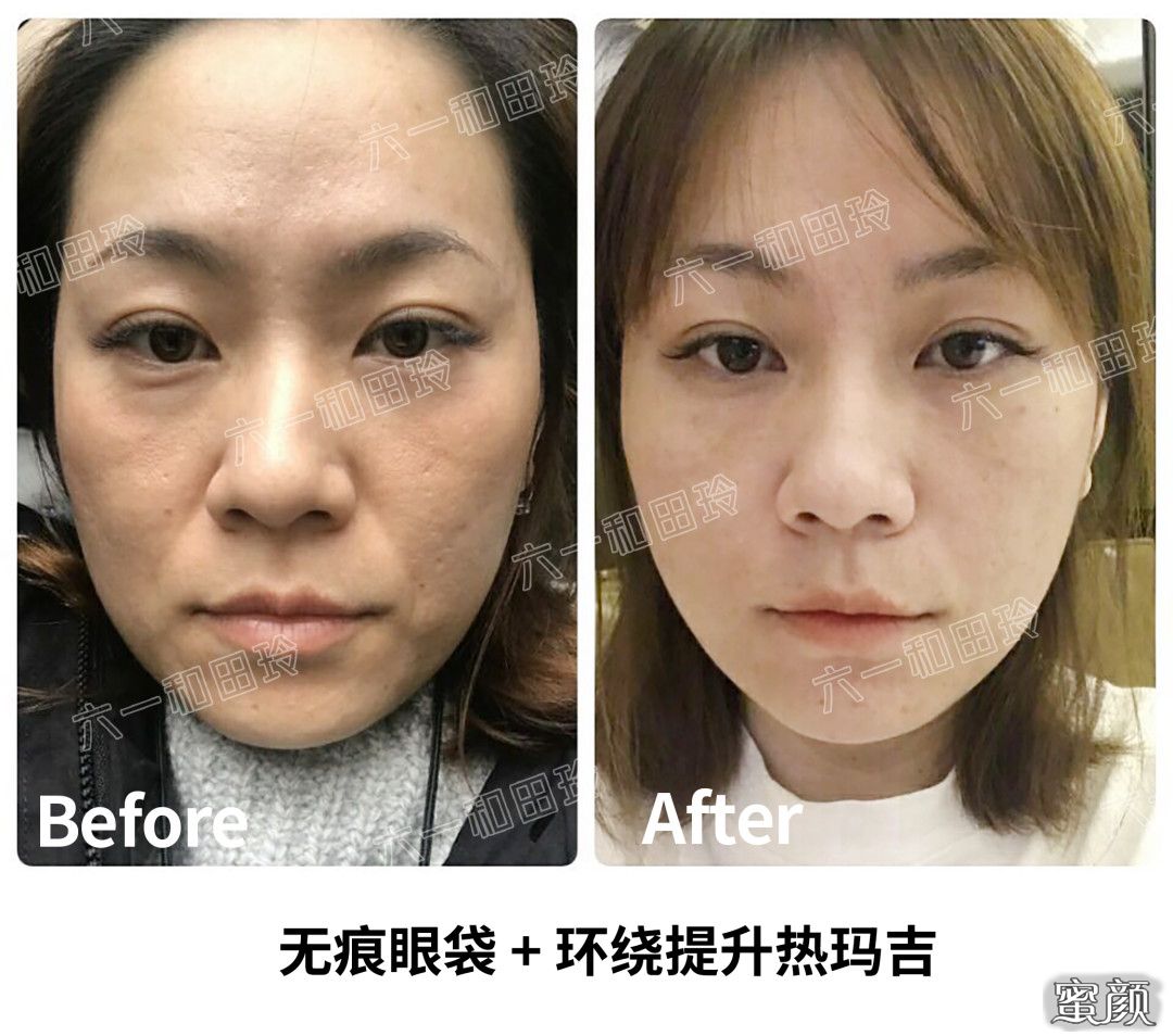 https://img.yiyiaimei.com/mnt/timg/200524/11201624P-8.jpg 案例图片