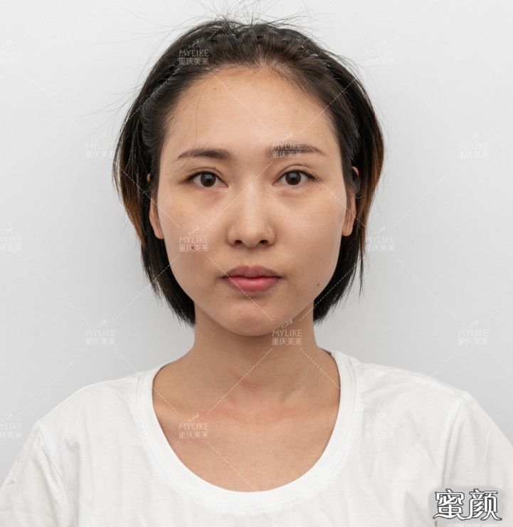 案例图片
