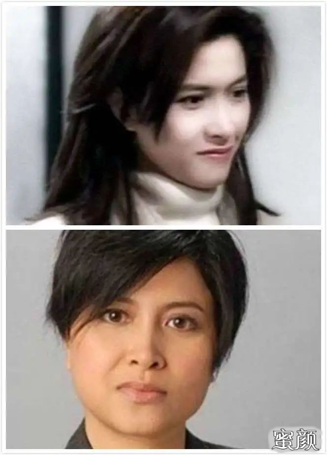 https://img.yiyiaimei.com/mnt/timg/200526/123K4D57-4.jpg 案例图片