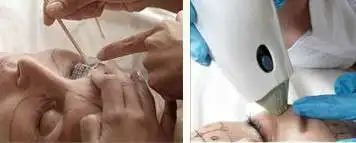 https://img.yiyiaimei.com/mnt/timg/200526/123K55515-5.jpg 案例图片