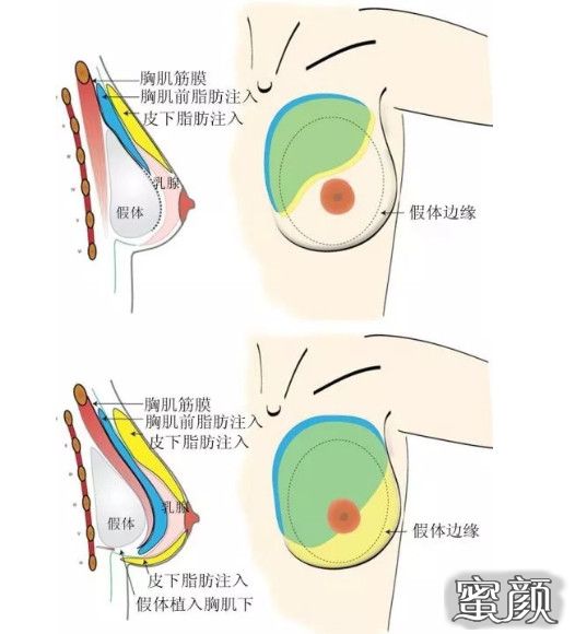 案例图片