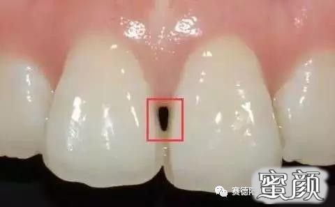 案例图片