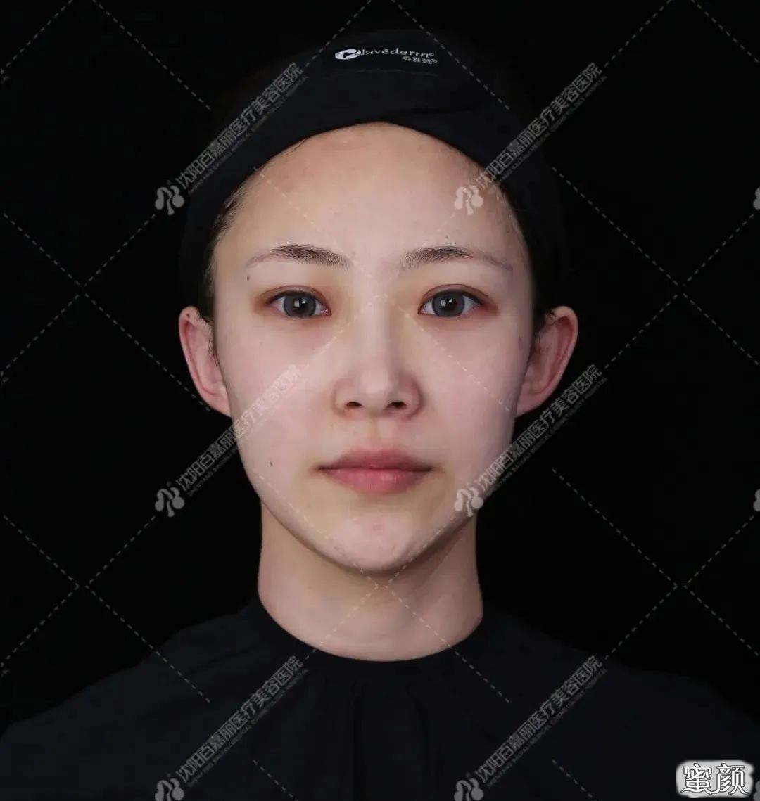 案例图片