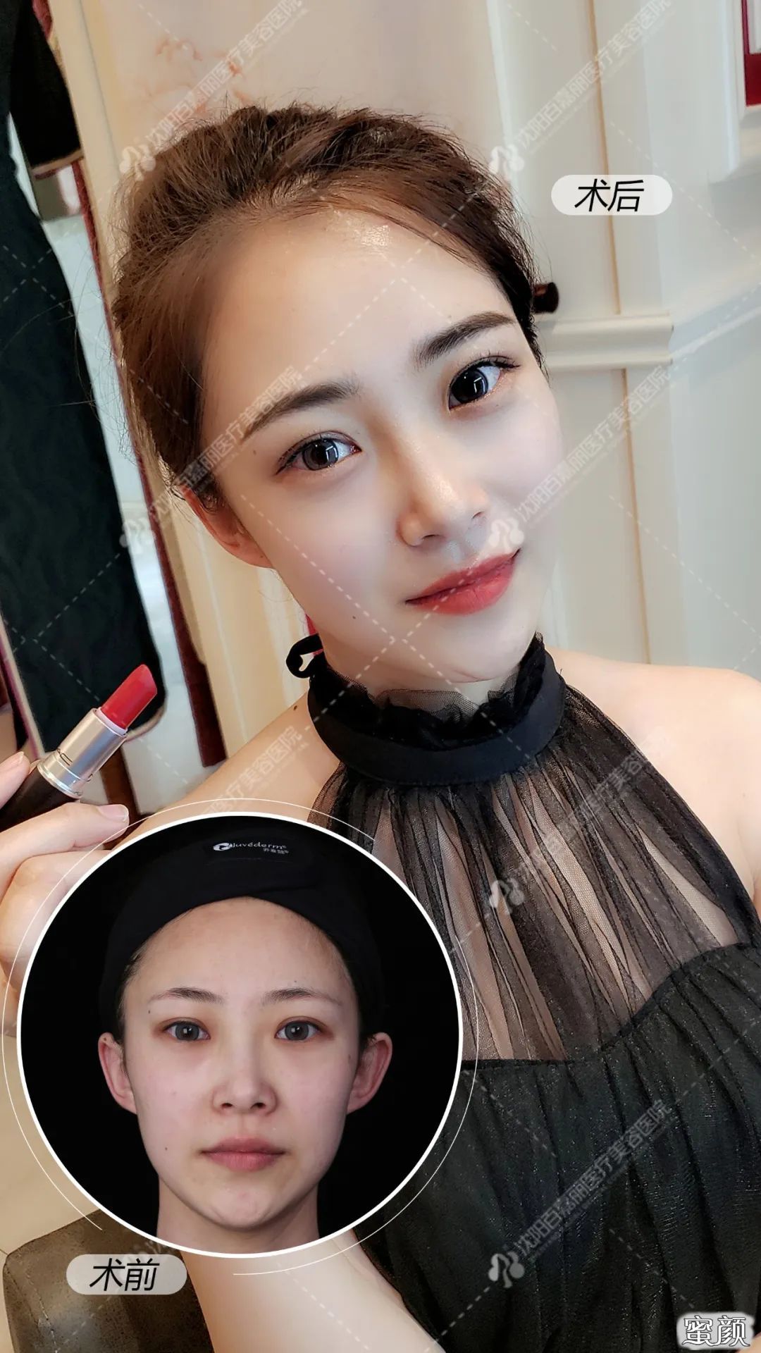 案例图片
