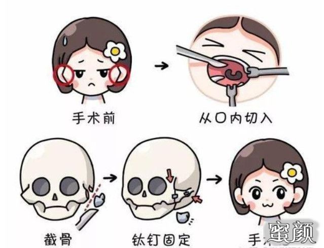 https://img.yiyiaimei.com/mnt/timg/200527/135059A44-1.jpg