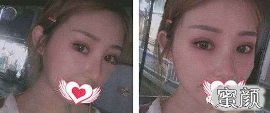 案例图片