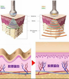 https://img.yiyiaimei.com/mnt/timg/200529/11345UE0-8.jpg 案例图片