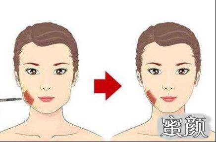 https://img.yiyiaimei.com/mnt/timg/200529/11350G201-12.jpg 案例图片