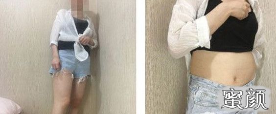 案例图片