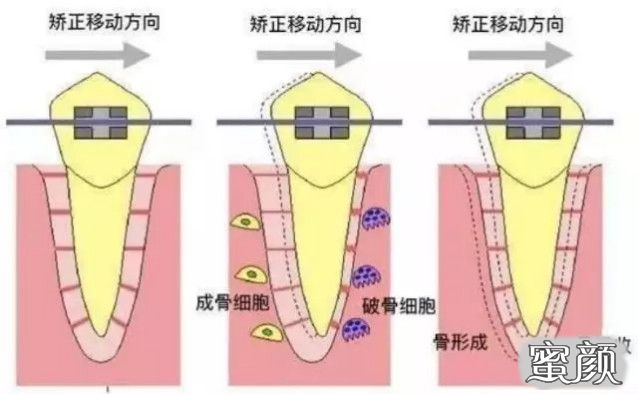 案例图片