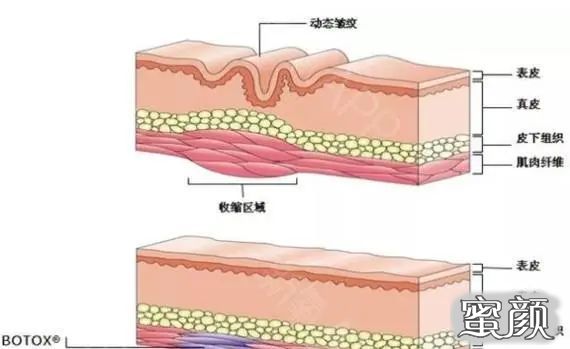 案例图片