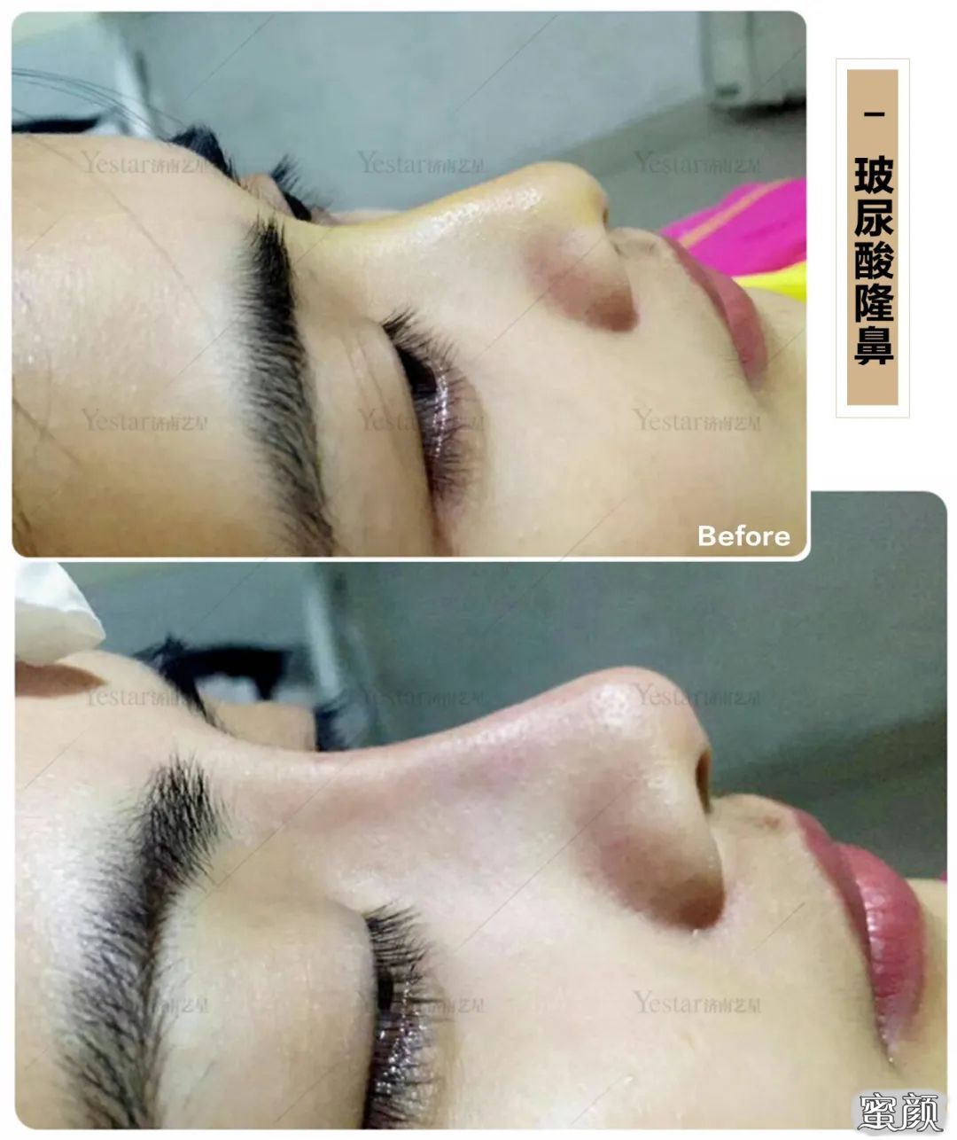 https://img.yiyiaimei.com/mnt/timg/200529/135113F94-2.jpg