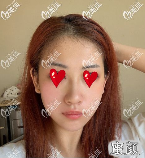 https://img.yiyiaimei.com/mnt/timg/200530/142U01924-1.jpg